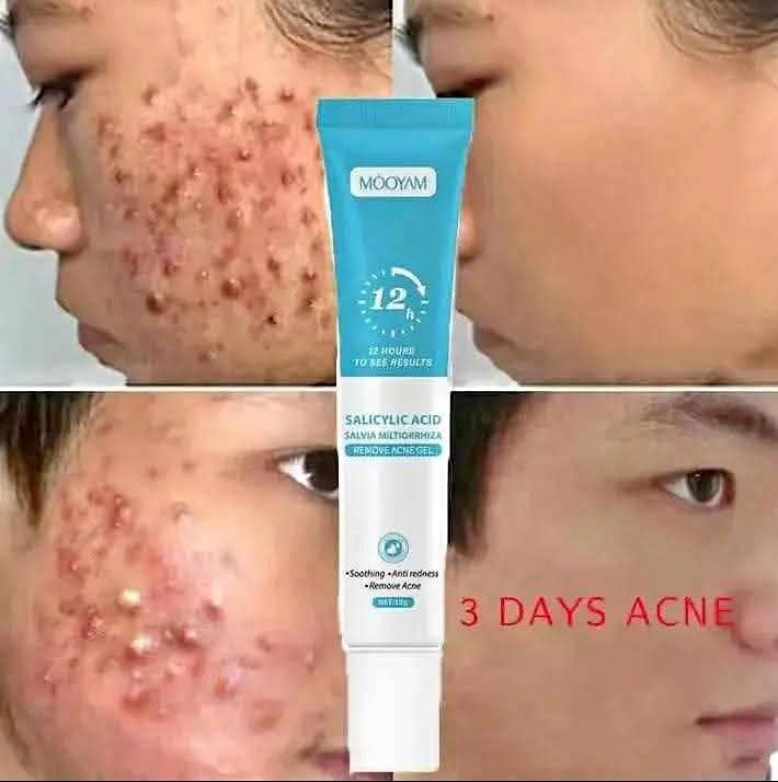 Gel anti-taches pour éliminer les imperfections, lisse la peau.