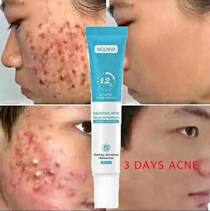 Gel anti-taches pour éliminer les imperfections, lisse la peau.