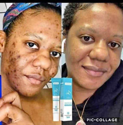 Gel anti-taches pour éliminer les imperfections, lisse la peau.